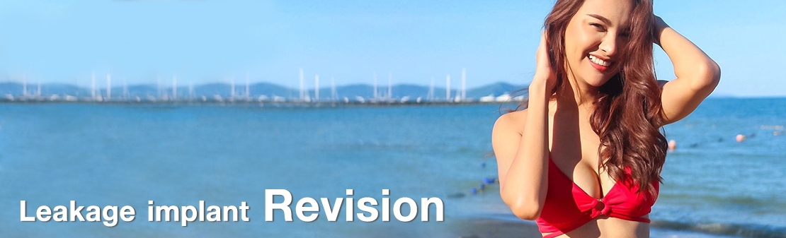 Revisão de implante com vazamento