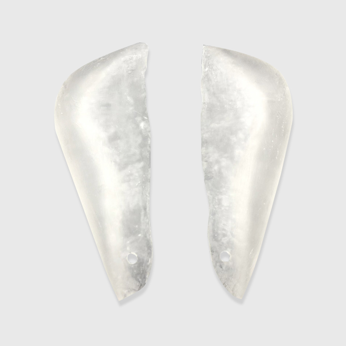 Cuztomized_Jaw_Implant2