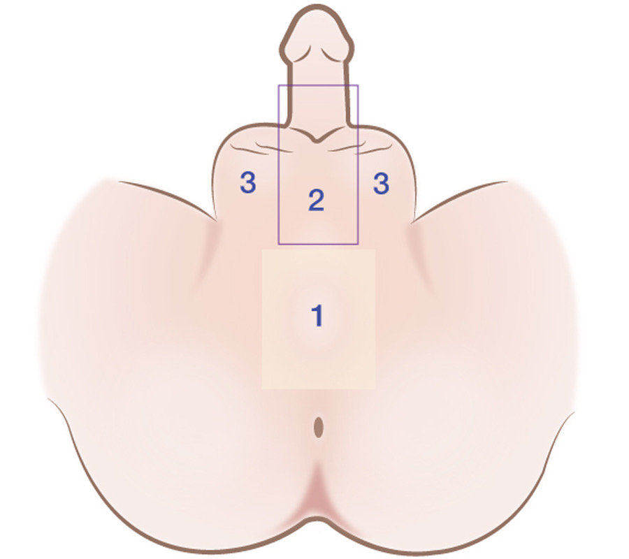 Area_of_the_hair_removal