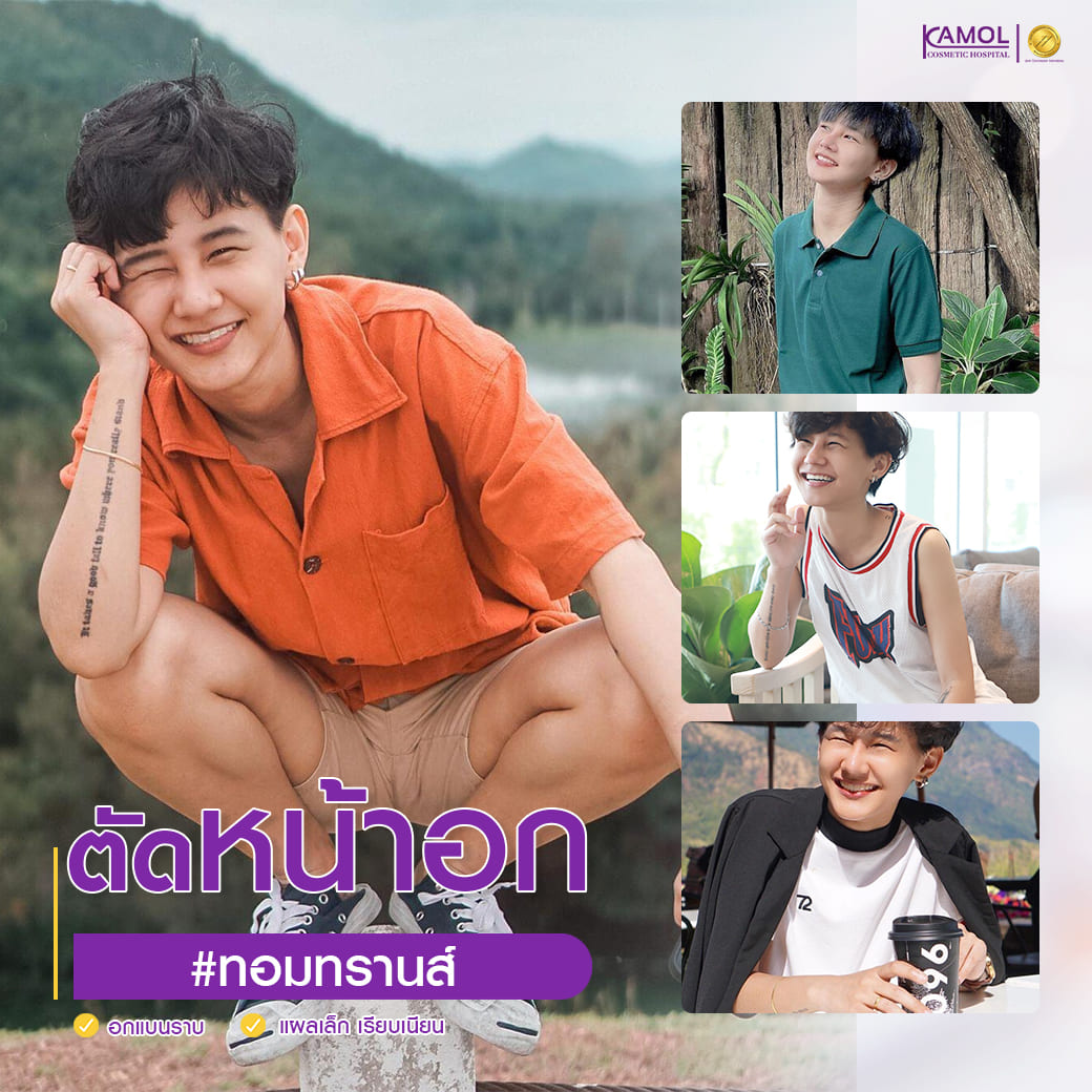 ตัดหน้าอก_แผลเล็ก_เรียบเนียน