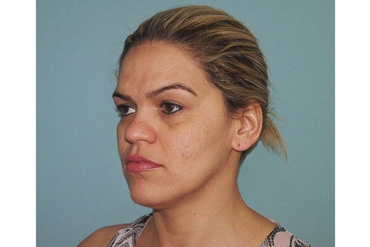 Revue de la chirurgie du visage / du remodelage du visage