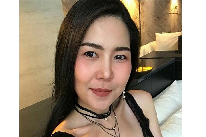 Cheekbone Reduction, Zygoma Reduction